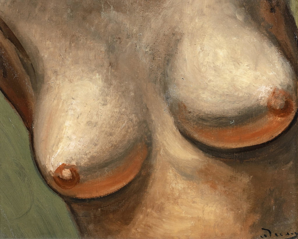 Poitrine de femme by Andre Derain sold for $302,500 (771% above estimate). Image courtesy of Sotheby's